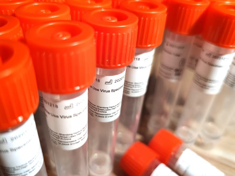 Corona-Schnelltest, über dts Nachrichtenagentur